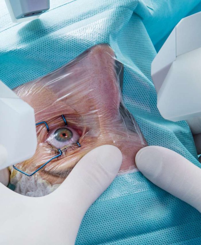 Perfect LASIK Surgery: Common Fears and How to Overcome Them